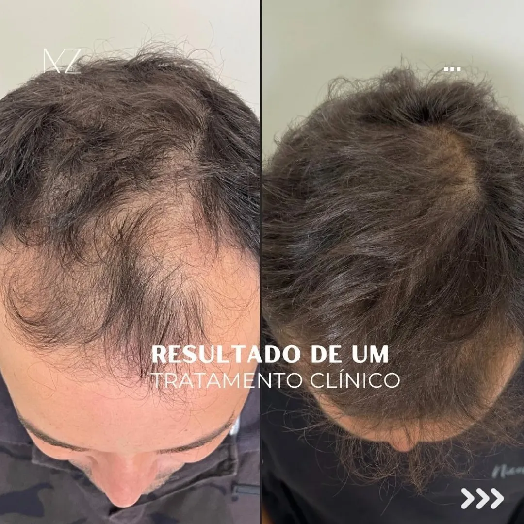 Design-sem-nome-2025-02-24T105931.506-2.webp