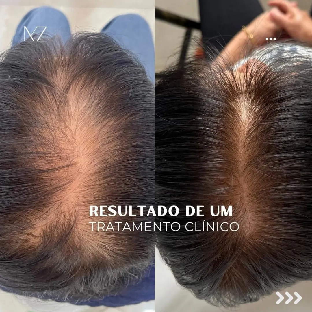 Design-sem-nome-2025-02-24T105931.506.webp
